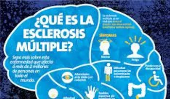 Conoce estos efectivos remedios para la esclerosis múltiple 