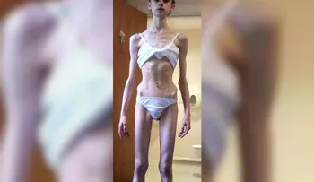 Increíble transformación: de la anorexia a ser luchadora de artes marciales mixtas