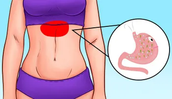 Si siente un dolor abdominal superior tiene un exceso de gases
