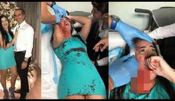 La colombiana que hirió hija de diputado tiene tres identidades