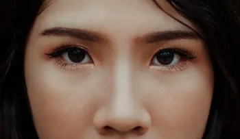 Remedios que funcionan para acabar con las ojeras