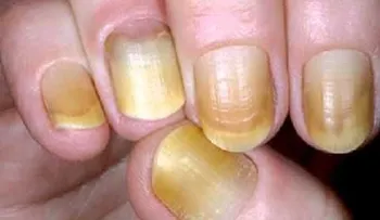 Tus uñas son capaces de decirte más de lo que crees; problemas de salud que te advierten 
