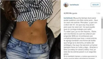 Karla Fatule publica foto en Instagram donde muestra sus estrías