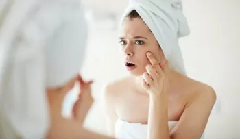 5 aceites esenciales para combatir el acné