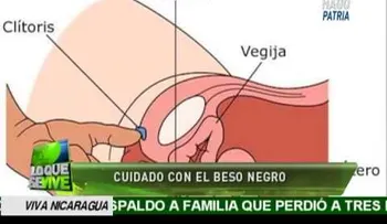 Tenga cuidado con el beso negro! (VIDEO)