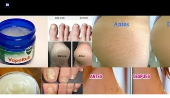 13 usos increíbles Vicks VapoRub que Te Sorprenderán