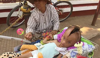 Familia del niño de Camboya con su cabeza partida en dos, busca ayuda desesperada 