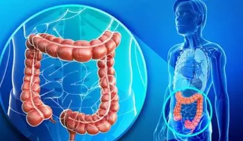 Consejos para tratar el sobrepeso y colon intoxicado