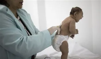 ¿Pueden los científicos vincular el zika y la microcefalia?