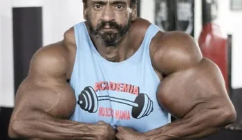 El hombre que se inyecta aceite en los bíceps para parecerse a Hulk 