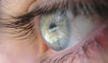 Identifican el gen de los ojos azules, las pecas y el pelo claro
