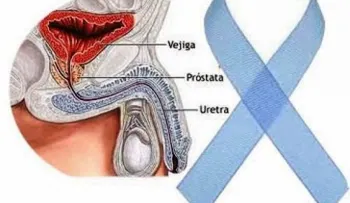 La ciencia busca favorecer a los pacientes con cáncer en su diagnóstico