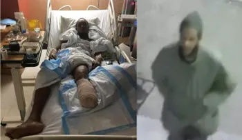 Dominicano acusado de empujar compatriota a vías del tren pierde parte de una pierna