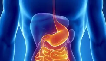 Enfermedad inflamatoria intestinal puede causar desnutrición