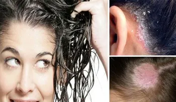 6 enfermedades que son causadas por dormir con el cabello mojado