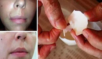 Increíble membrana para atenuar cicatrices y tratamiento para tu pelo: Descubre como usarla 