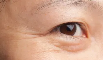 7 trucos de belleza usando vaselina