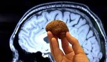 ¿Qué efectos causa en el cerebro comer cacao o chocolate?