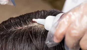 Oncólogo Héctor Manuel Rosario recomienda evitar el tintes en el cabello 