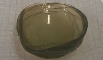 Doctores encuentran 27 lentes de contacto en el ojo de una mujer