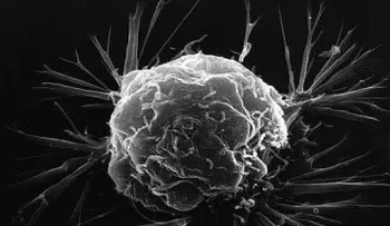 Eliminar ciertos aminoácidos en la dieta podría ayudar a combatir el cáncer