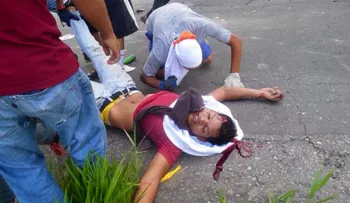 IMAGENES FUERTES: Otro disparo en la cabeza durante la represión del régimen militar de Maduro a las manifestaciones civiles