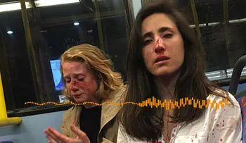 Una azafata uruguaya y su novia recibieron una terrible golpiza, porque se negaron a besarse