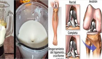 Esta mujer eliminó su dolor de rodillas y articulaciones en 1 día sin ir al doctor por ella misma!!!?