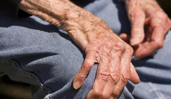 Entérate aquí cómo vivir con artritis reumatoide y sus recomendaciones
