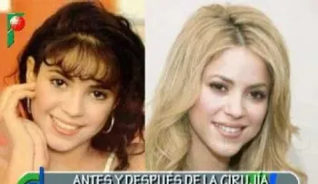Famosas Latinas antes y después de la cirugía