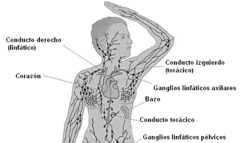 Si tiene Linfoma de Hodgkin, estas son las pruebas que debes someterte y el tratamiento que debes llevar