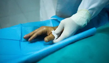 Científicos hallan el código genético para regenerar extremidades