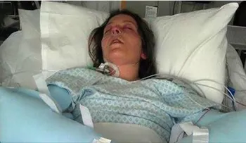Mujeres tengan mucho cuidado: pueden perder la memoria, cabello y uñas usando esto