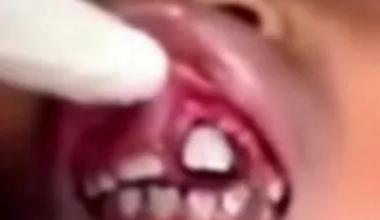Esta niña sintió que en su boca algo que se arrastraba? ¡Qué escalofríos!