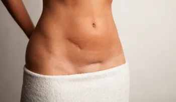 7 remedios naturales para disminuir las cicatrices de la piel