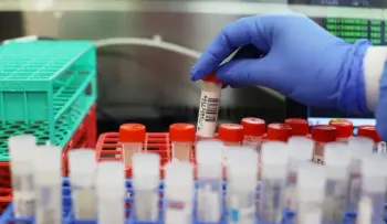 La variante ómicron ya está en casi 60 países, pero con casos leves