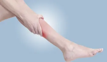 5 consejos para evitar calambres en las piernas