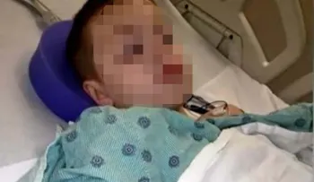 Ingresan niño de 9 años en hospital por mordedura de tiburón en Miami Beach