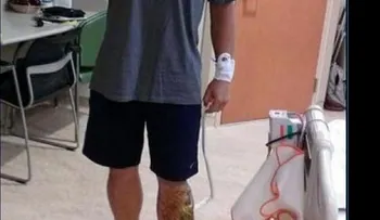 Lo ataca un tiburón, lo muerde dos veces una serpiente, le caen cuatro rayo, y sobrevive  