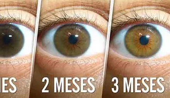 Aumenté mi visión en 3 meses y evité una cirugía con esta simple receta natural