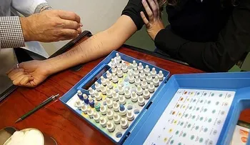 Las alergias alimentarias se previenen desde bebés