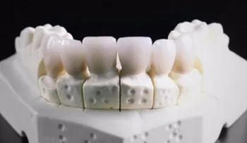 Crean dientes con impresión 3D que serán antibacterianos