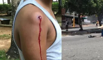  Hieren de bala dirigente estudiantil en medio de disturbios en la UASD 