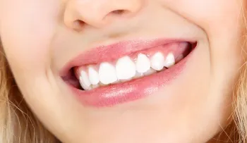 Cuida tus dientes con productos 100% naturales