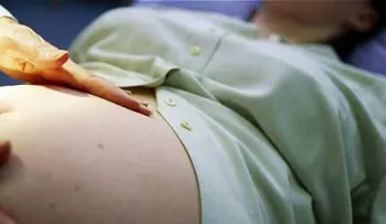 Venezuela reporta primer caso de microcefalia en feto de embarazada con Zika