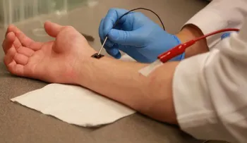 Un dispositivo "milagroso" permite con células de tu propia piel reparar órganos, vasos sanguíneos y nervios 