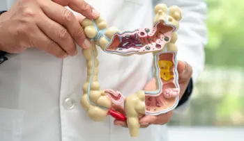 Crohn y colitis ulcerosa: enfermedades crónicas que inflaman el intestino