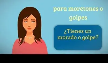 Remedios caseros para moretones o golpes