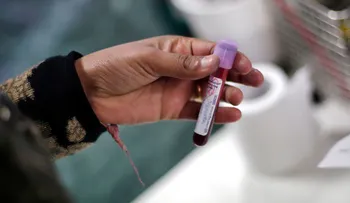 La India afirma haber "cultivado con éxito" en laboratorio la nueva variante británica del coronavirus