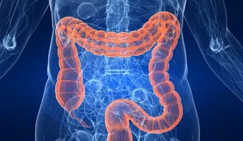 Cáncer rectal: Síntomas, diagnóstico y tratamiento